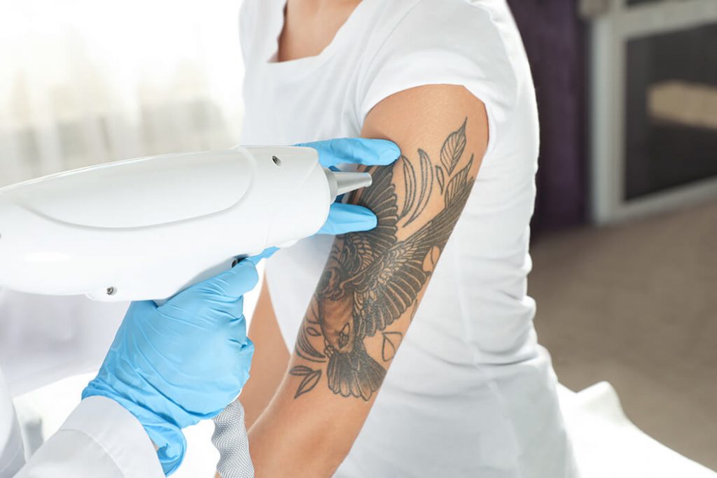 Best Tattoo Removal Clinics in Royal North Shore Hospital | Bookwell